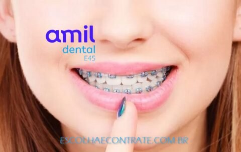 Amil Dental E80 Aparelho Documentações e Manutenções Ortodônticas