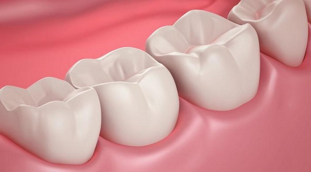 Prótese de Porcelana e Cerâmica no Plano Dental por R$ 183,60/mês