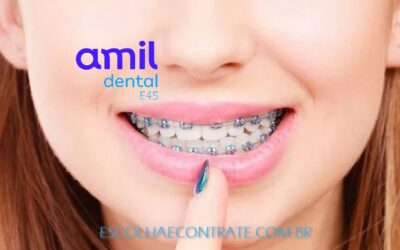 Amil Dental E80 cobre aparelho,documentações e manutenções ortodônticas ! 5 (2)