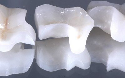 Amil Dental cobre bloco ? Descubra aqui 5 (1)