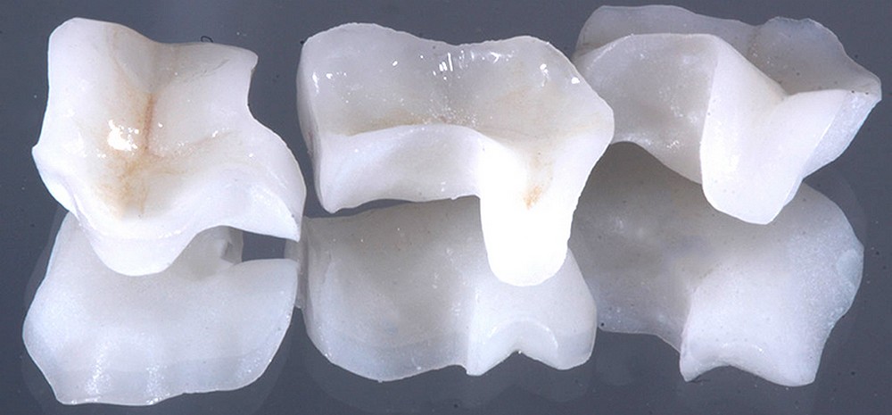 amil-dental-cobre-bloco