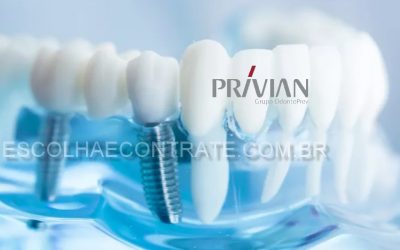 Plano Odontológico que cobre implantes empresarial sem carência 5 (1)