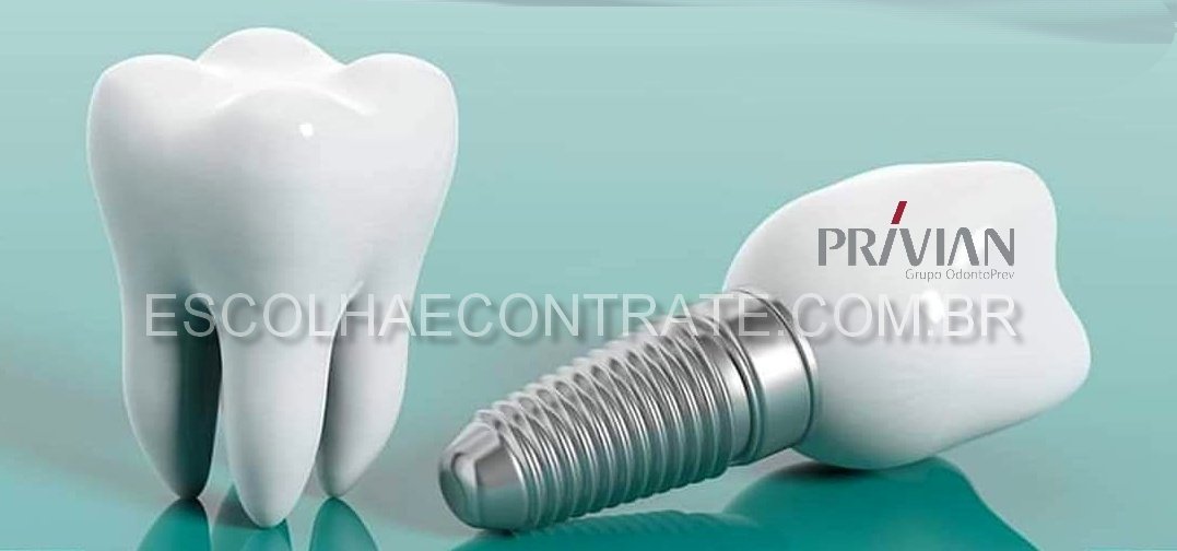 Plano Premium Odontoprev cobre implantes sem carência